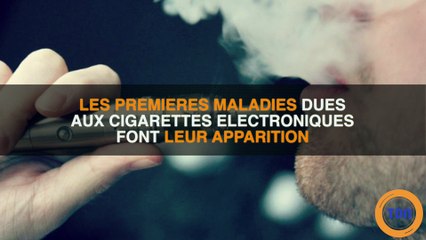Les premières maladies dues à la cigarette électroniques sont-elles en train d'arriver ?