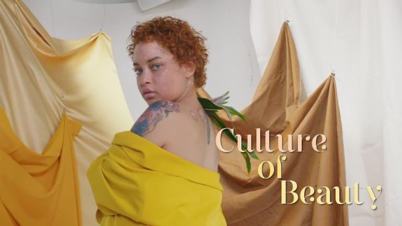 How This Lupus Advocate Finds Beauty in Illness