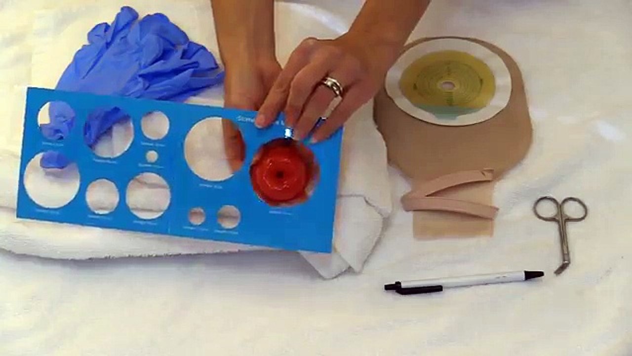Ostomy Bag Pouch Change | Ostomy Care Nursing | Colostomy, Ileostomy ...