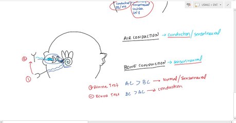 Weber and Rinne Tuning Fork tests for USMLE