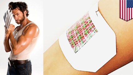 This 'smart bandage' will help you heal like the Wolverine