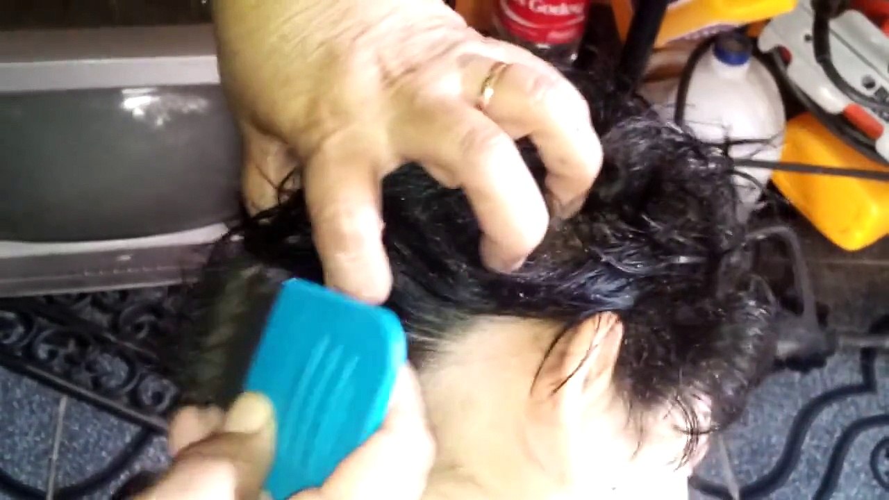 Cette petite fille a les cheveux infestés de poux