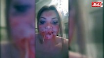 Djali trembet për vdekje, nga e dashura e gjakosur dhe me buzët e qepura (360video)