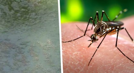 டெங்கு கொசுவிற்காக  2000 கடைகளுக்கு நோட்டீஸ்..சென்னையில் அதிரடி!-வீடியோ