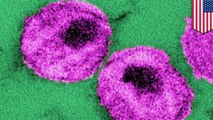 Obat HIV? Molekul ini dapat membuang dan membunuh sel HIV aktif yang bersembunyi di tubuh - TomoNews