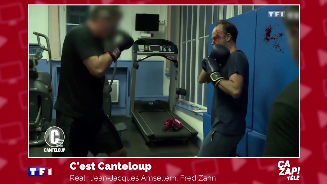 Edouard Philippe en sang ?