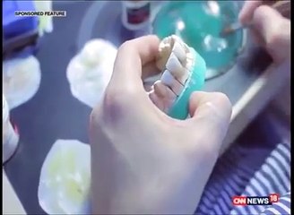 Best Zygomatic Implant Awards India