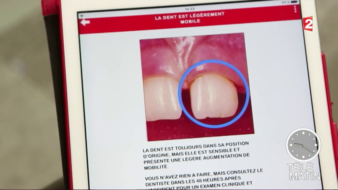 Santé - Dents : une appli d’urgence