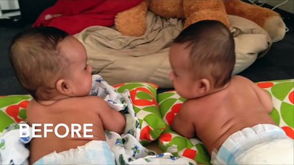 How to Make a Baby Pillow to Prevent Flat-Baby Heads (Plagiocephaly)