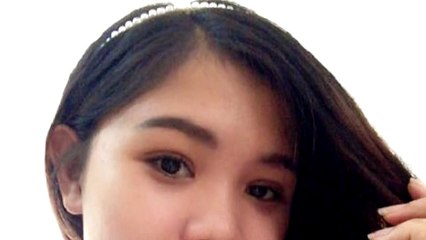 Nhấn mí Hàn Quốc có nguy hiểm không?