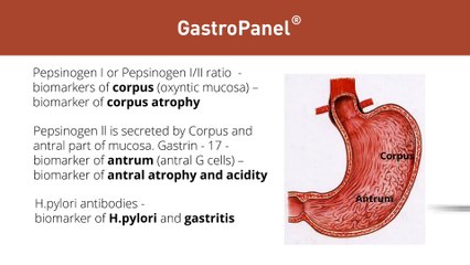 Sneak peek into revolutionary non-invasive approach to diagnosis of digestive disorders