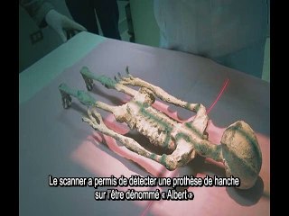 Les Etres mystérieux de Nasca - Analyse du scanner d'Albert par le Dr Salas Alfaro - N° 6 - Analyses-