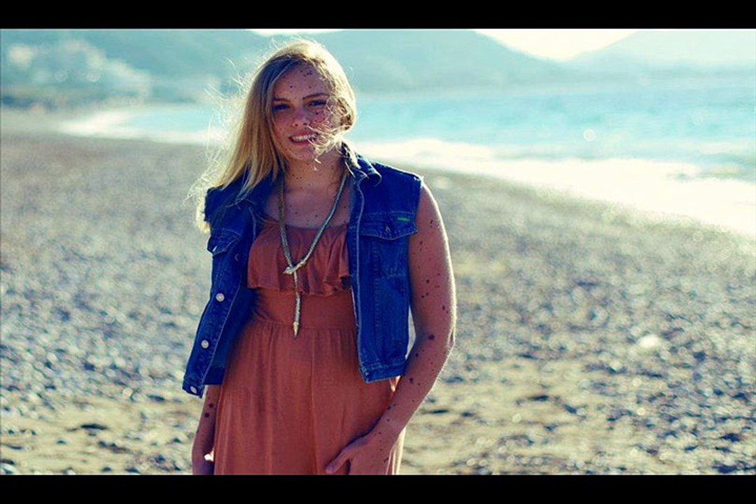 Woman with birthmark that covers her stomach and thighs vows she'll never remove it.