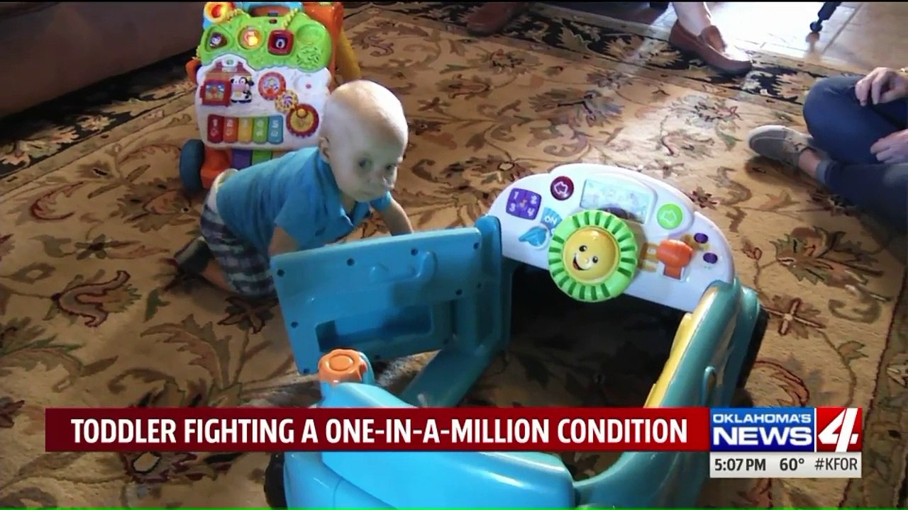 Infant Diagnosed With Rare Disease After Parents Notice Strange Rash