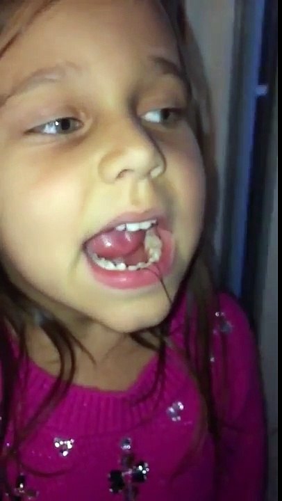 Sa dent s'envole attachée à une porte ! ça marche !!