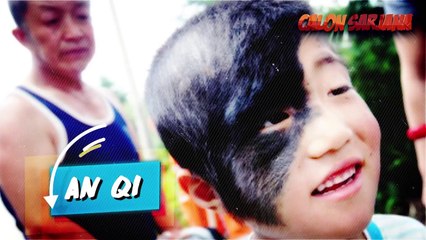 10 ANAK PALING TIDAK BIASA YANG LAHIR DENGAN KONDISI SUPER UNIK!!! WAJIB LIHAT!