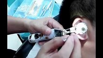 Chinese Ear Cleaning (108) 10 minutes of Ear Cleaning Relaxation and Stress Relief