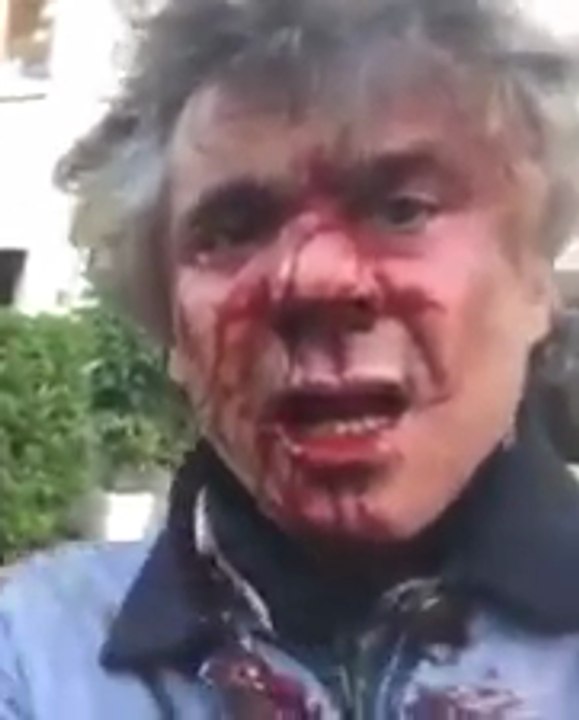 Algérie, FLN, Amar Saâdani (1), son fils tente de Tuer Rachid NEKKAZ,محاولة قتل