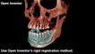 Open Inventor Medical Edition | Multimodality Rigid Registration | 3D Visualization Toolkit