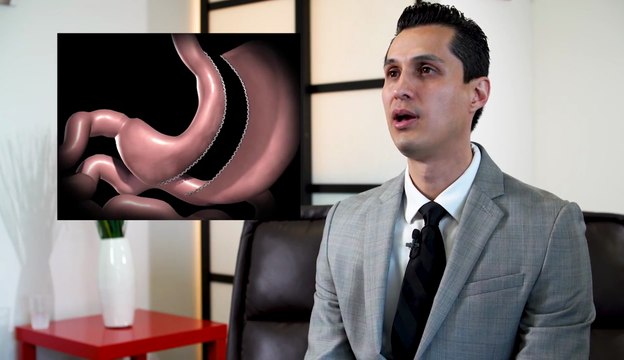 Gastric Sleeve Surgery - Tijuana, Mexico - Monterrey, Mexico