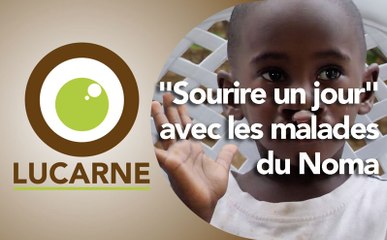 Lucarne : "Sourire un jour" avec les malades du Noma