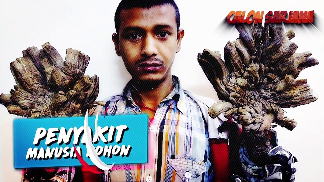 10 PENYAKIT PALING MENGERIKAN & MENGAGETKAN YANG BISA SAJA KALIAN ALAMI!!!