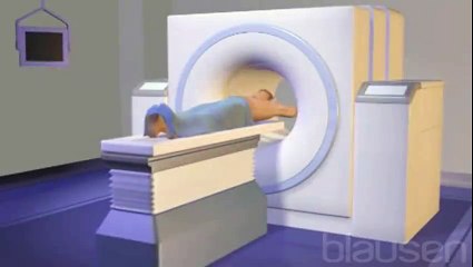 Diagnostic du cancer    le scanner TEP-TDM