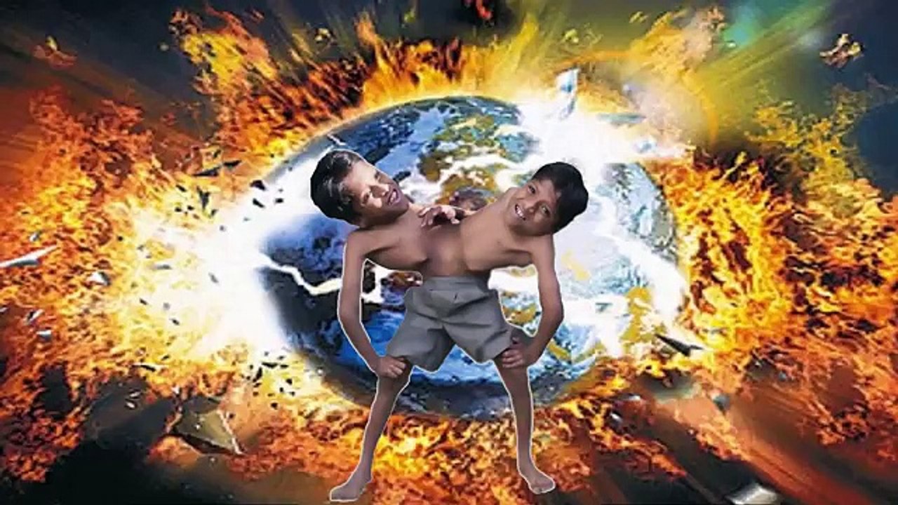 5 GEMELOS SIAMESES Más Increíbles en la Actualidad