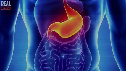 Weirdest Medication Side Effects