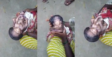 Strange baby born in India