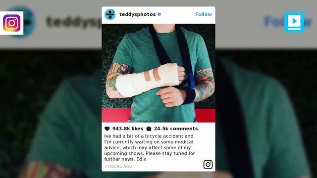Ed Sheeran injured after cycling accident