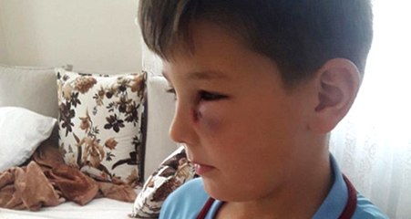 Trabzonsporlu Küçük Taraftarın Gözüne, 6-1'lik Maçta Davulcu Tokmağı Geldi