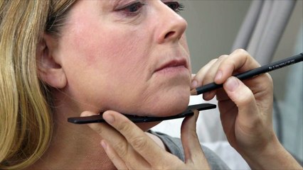 SculpSure FDA Cleared for Submental Lipolysis