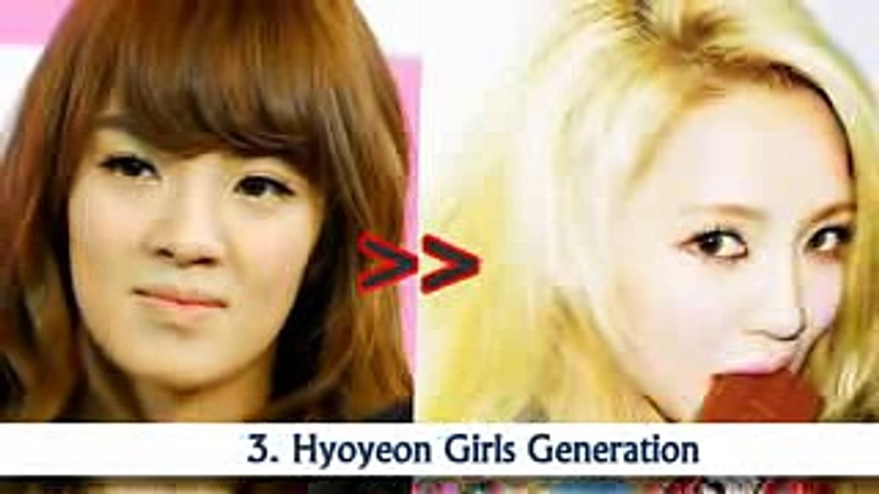 10 Seleb Korea Before And After Oplas
