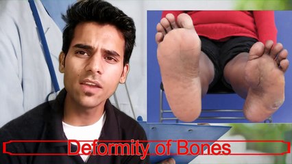 Indian Army Medical Procedure | Diseases for Rejection | Check up Doctors