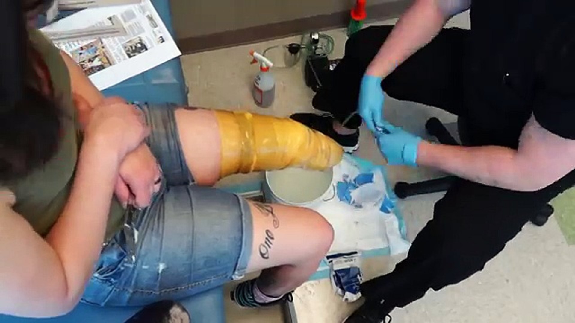 AmputeeOT: How a prosthetic running leg is made!