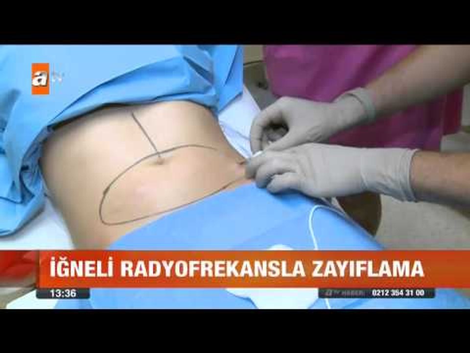 Zayıflama ve sıkılaşmada yeni yöntem - atv Gün Ortası Bülteni