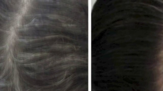 Reverse Gray Hair Fast! Subliminals Frequencies Hypnosis