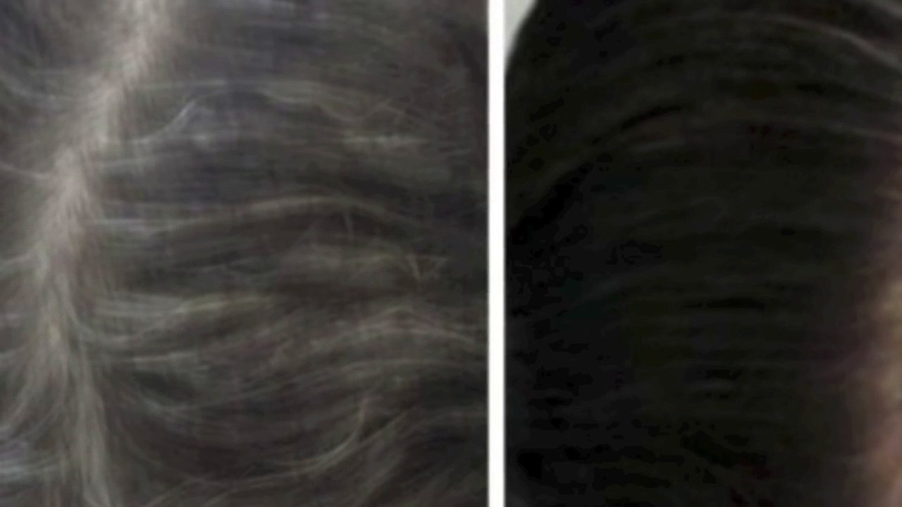 Reverse Gray Hair Fast! Subliminals Frequencies Hypnosis