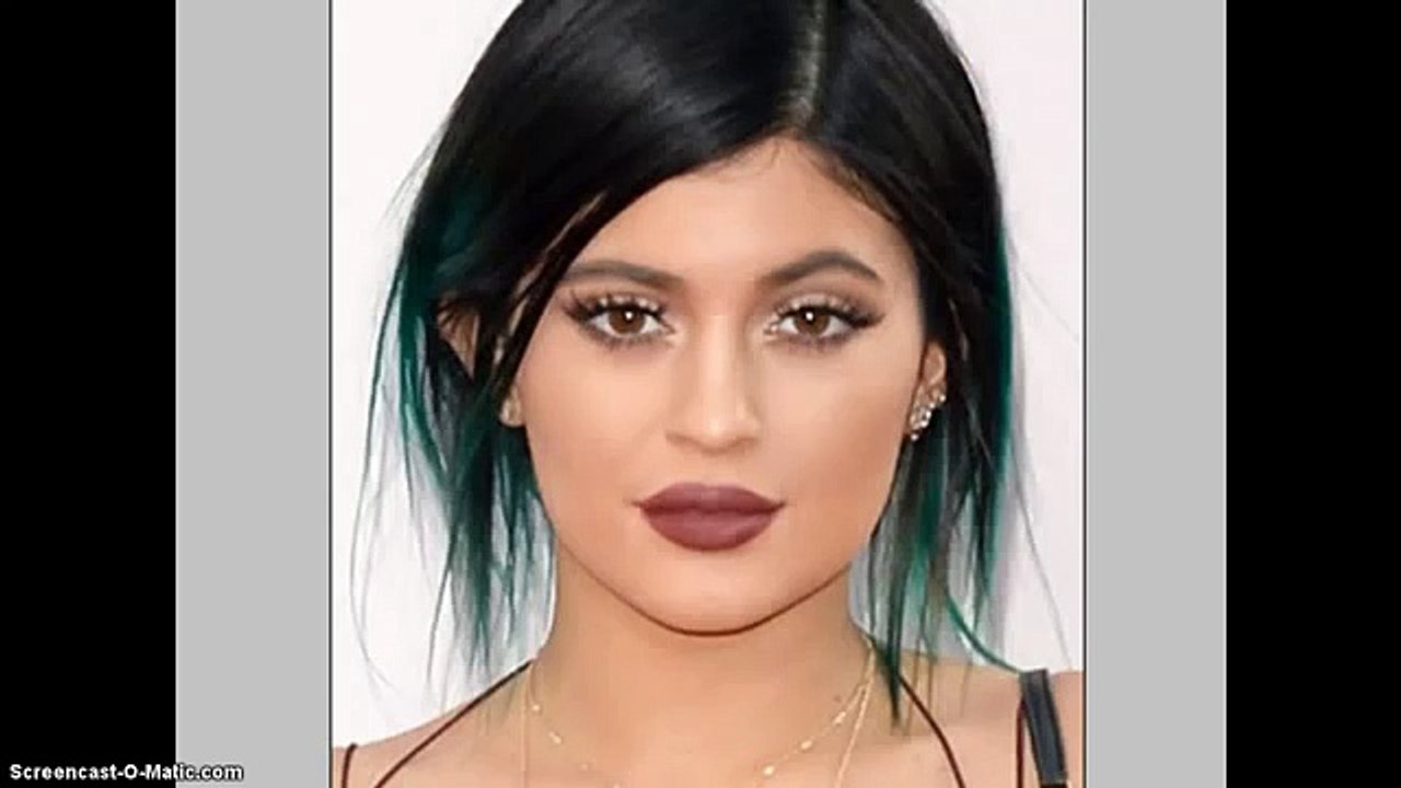 Kylie Jenner Before and After Plastic Surgery (Those Lips!.. and Jaw Bone Too!)