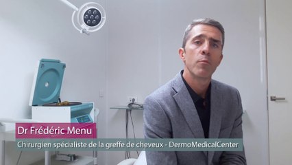 La greffe pour lutter contre la chute de cheveux