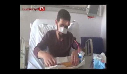 Yüzüne ateş eden genç 37. kez ameliyat olacak