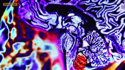 ONLY A TRUE GENIUS CAN SCORE 14/14 ON THIS RIDDLE QUIZ