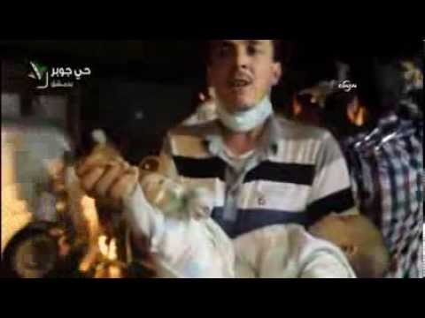 Kimyasal saldırıda ikizlerini kaybeden babanın feryadı