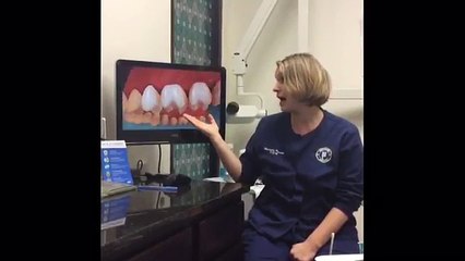 Why You Should Floss Your Teeth