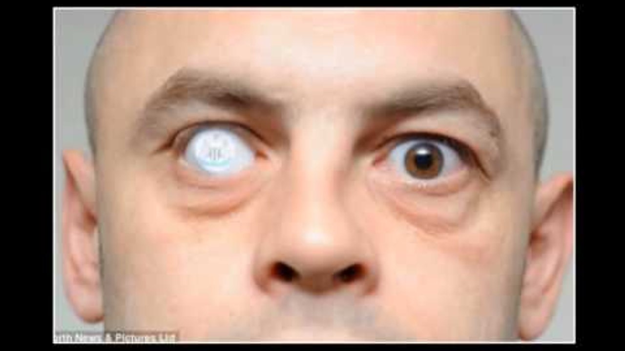 Два глаза мужские. Как выглядит человек в глазах другого. Реалистичный глаз. Глаза разного цвета. Глаза в разных стрроны.