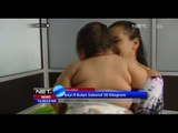 NET12 - Seorang bayi di Kolombia memiliki berat badan hingga 20 kg