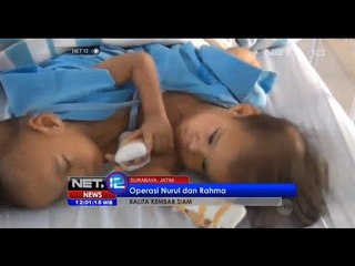 Descargar video: NET12 - Balita kembar siam di RS Dokter Sutomo Surabaya jalani proses operasi pemisahan