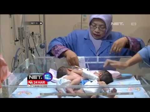 NET12 - Bayi kembar siam di Ponorogo