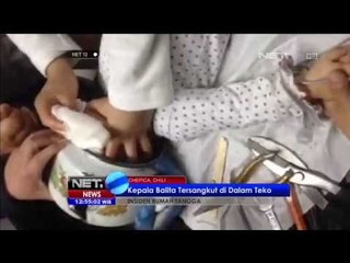 Kepala seorang bocah tersangkut dalam teko besi saat bermain - NET12
